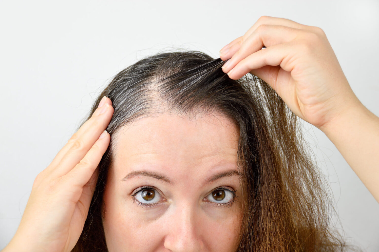 Queda de cabelo pode ser evitada e tratada