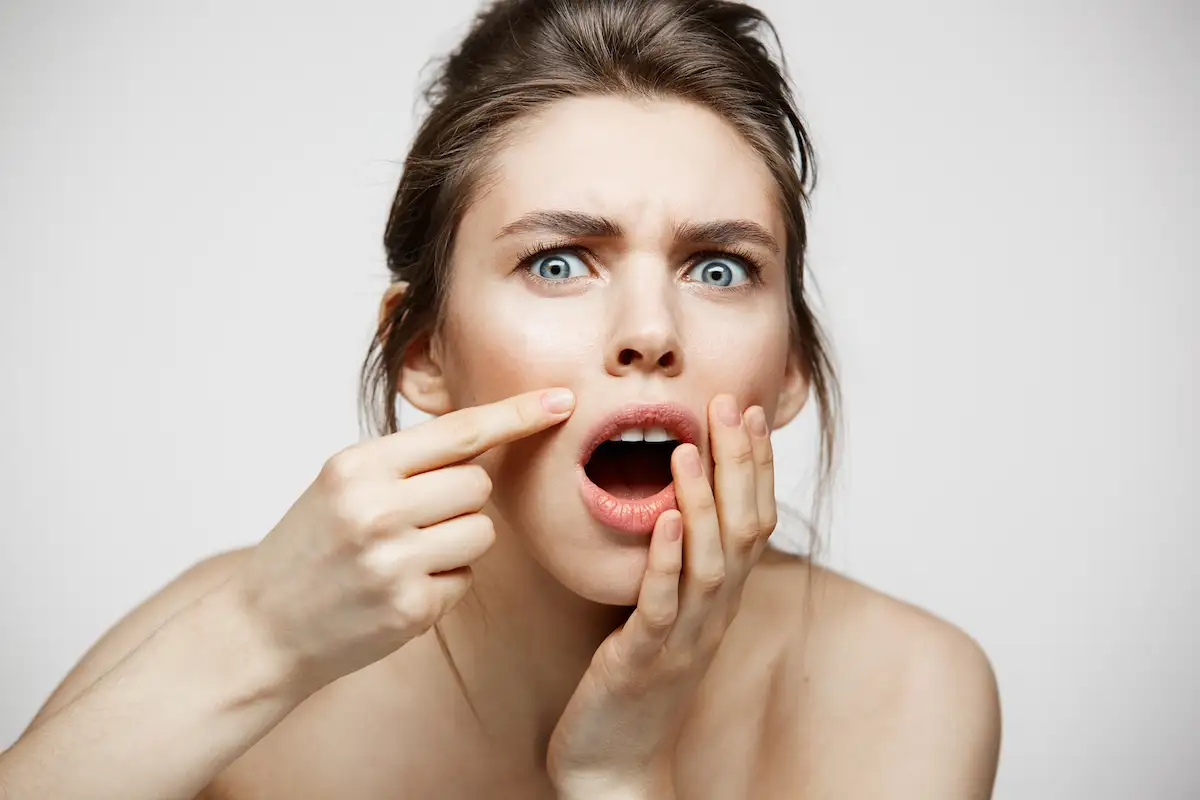 Dermatologista avaliando pele com acne em consultório em Goiânia