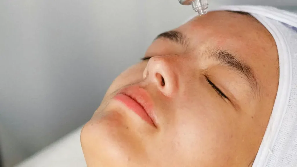 Dói fazer laser de picossegundos para melasma? Dói fazer laser de picossegundos para melasma
