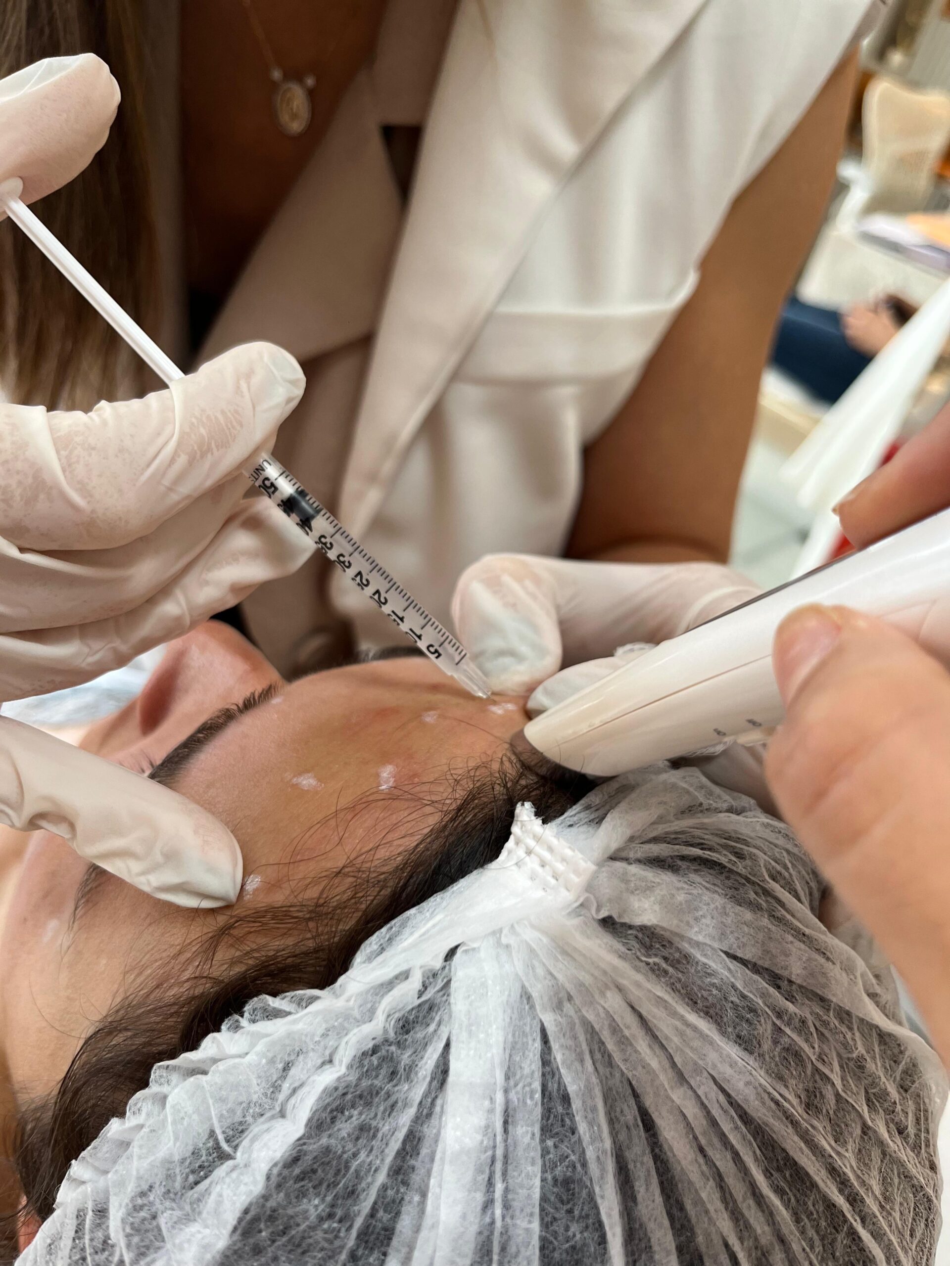 Botox