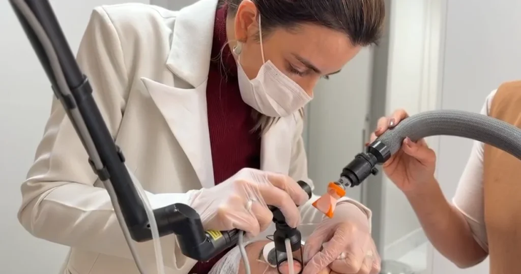Laser CO2 Hybrid: o que é, para que serve e se dói Laser CO2 Hybrid: Dra. Mariana Cabral aplicando o laser regenerativo no rosto de uma paciente