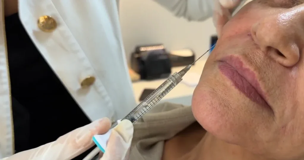 Skinvive ou Skinbooster: qual a diferença e qual escolher Skinvive ou Skinbooster: Dra. Mariana Cabral aplicando a hidratação injetável no rosto de uma paciente