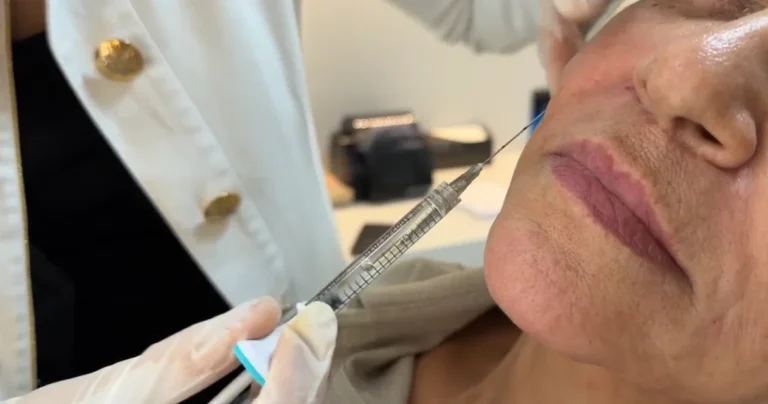Skinvive ou Skinbooster: qual a diferença e qual escolher