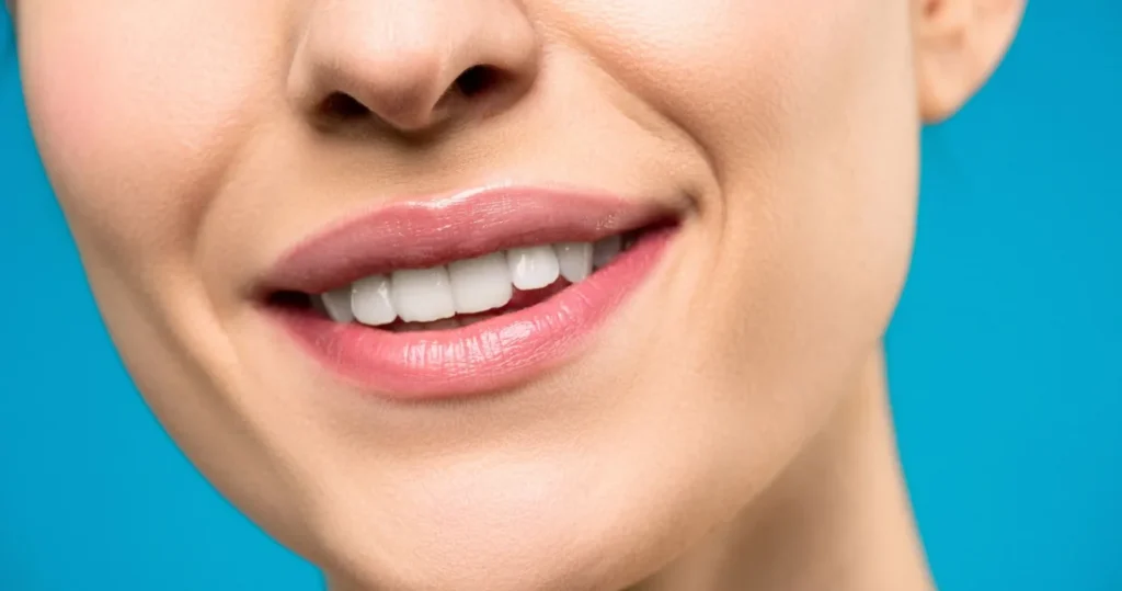Preenchimento labial: lábios de mulher com volume natural após o inchaço passar
